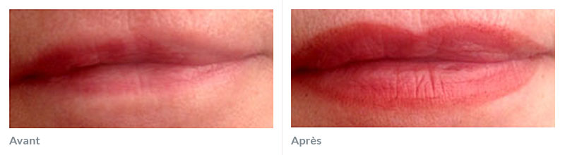 Maquillage permanent bouche avant après marwel