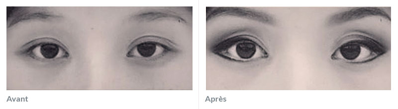 Maquillage permanent yeux avant après 1
